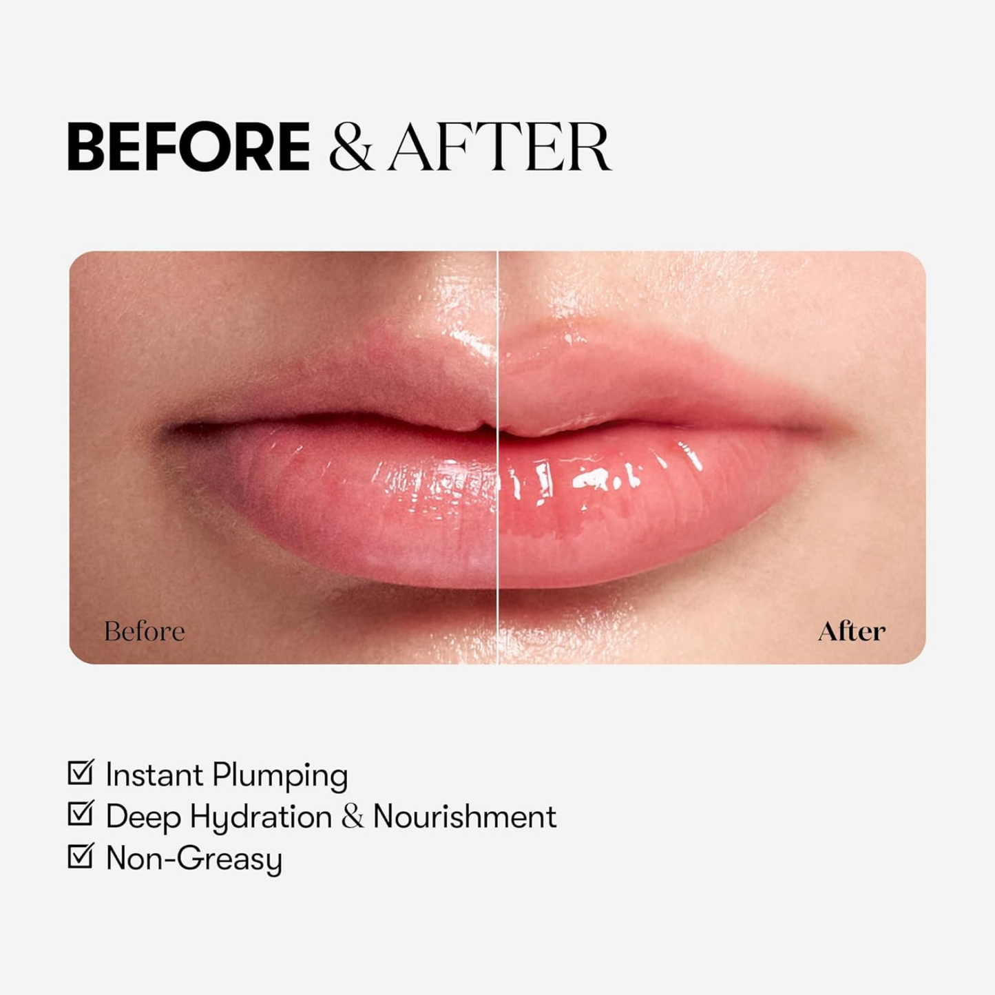 Before and after comparison of lips after the use of VT Cosmetics Reedle Shot Lip Plumper Beginner with text highlighting product features.