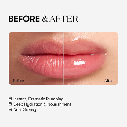 VT Cosmetics Reedle Shot Lip Plumper Expert before and after of lips as well as text on the benefits of using the product