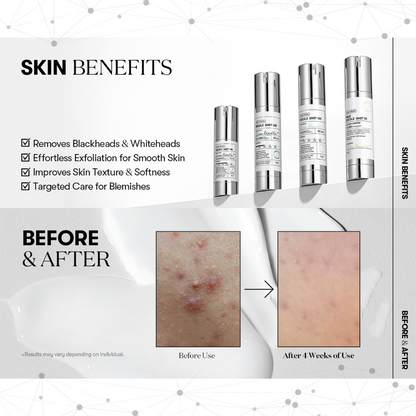 VT Cosmetics Reedle Shot 100 with before and after effects on skin.