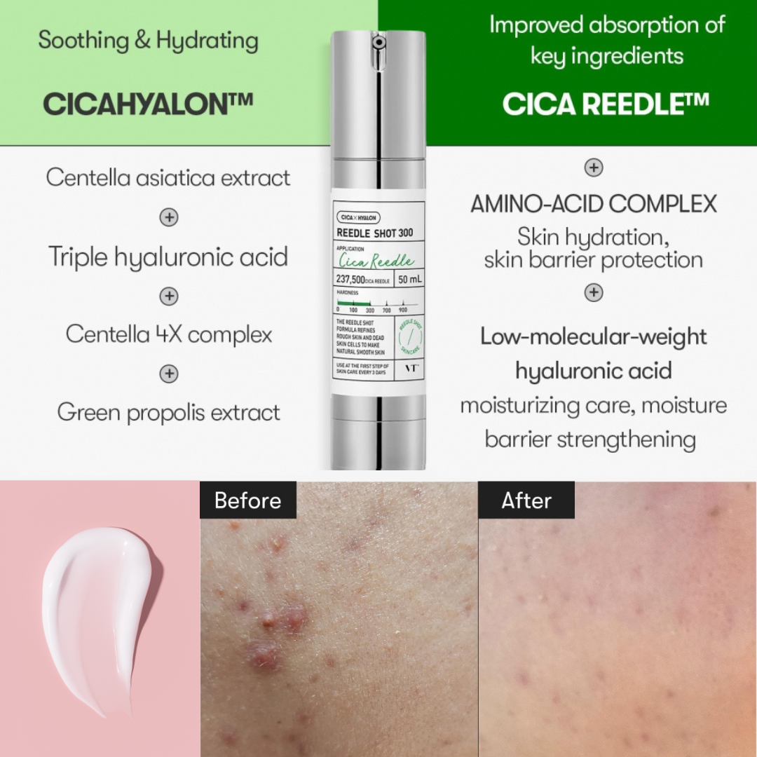 Cica Hyalon and Cica Reedle skincare products with text on benefits and before/after effects. VT Cosmetics Reedle Shot 300