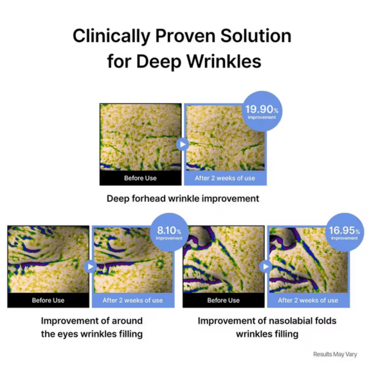 An infographic on a white background with the headline 'Clinically Proven Solution for Deep Wrinkles.' It shows before-and-after close-up panels of skin texture, with text labels for 'Before Use' and 'After 2 weeks of use,' plus improvement percentages and sections for deep forehead wrinkles and around-eye/nasal fold wrinkles. This relates to the use of  Celimax The Vita-A Retinal Shot Tightening Dual Cream for two weeks