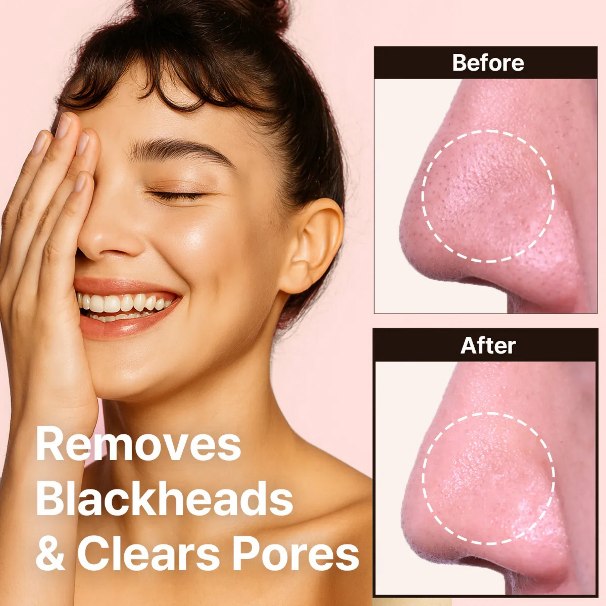 Woman with a smile, showing before and after effects of blackhead removal on her nose when using heimish All Clean Balm